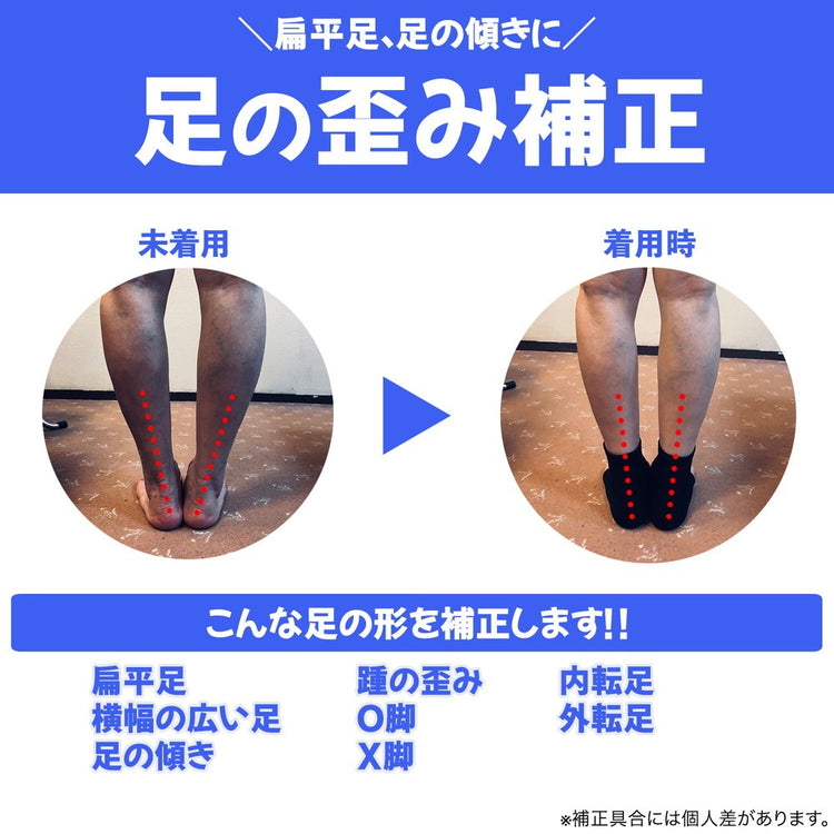 足首まもるくん アキレス腱サポート付 送料¥250(1個まで)